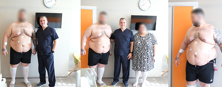 213 kg obezite hastası op.dr.Hüseyin Akyol ameliyatı